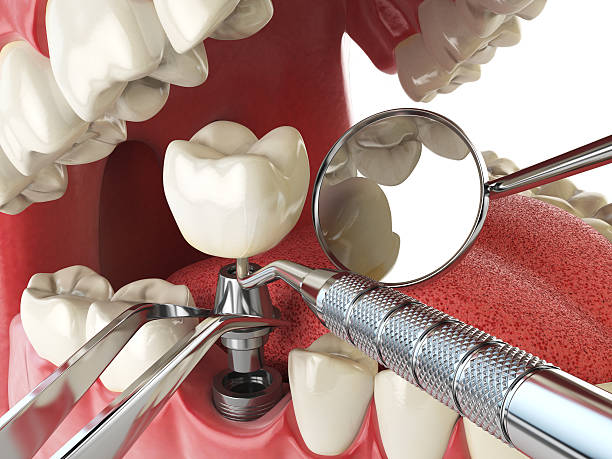 Best Emergency Dental Services Near Me  in North Shore, CA